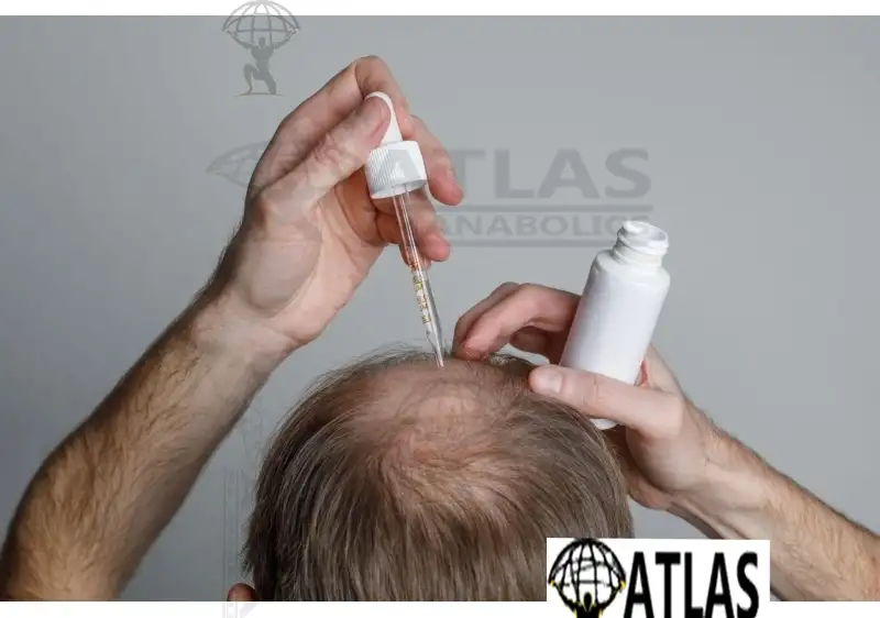 How to Buy Hair Loss Treatments Online Without Getting Scammed (2026 Update)